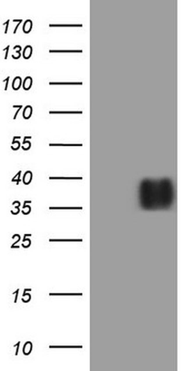 IL12A Antibody in Western Blot (WB)