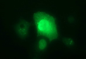 IL1A Antibody in Immunocytochemistry (ICC/IF)