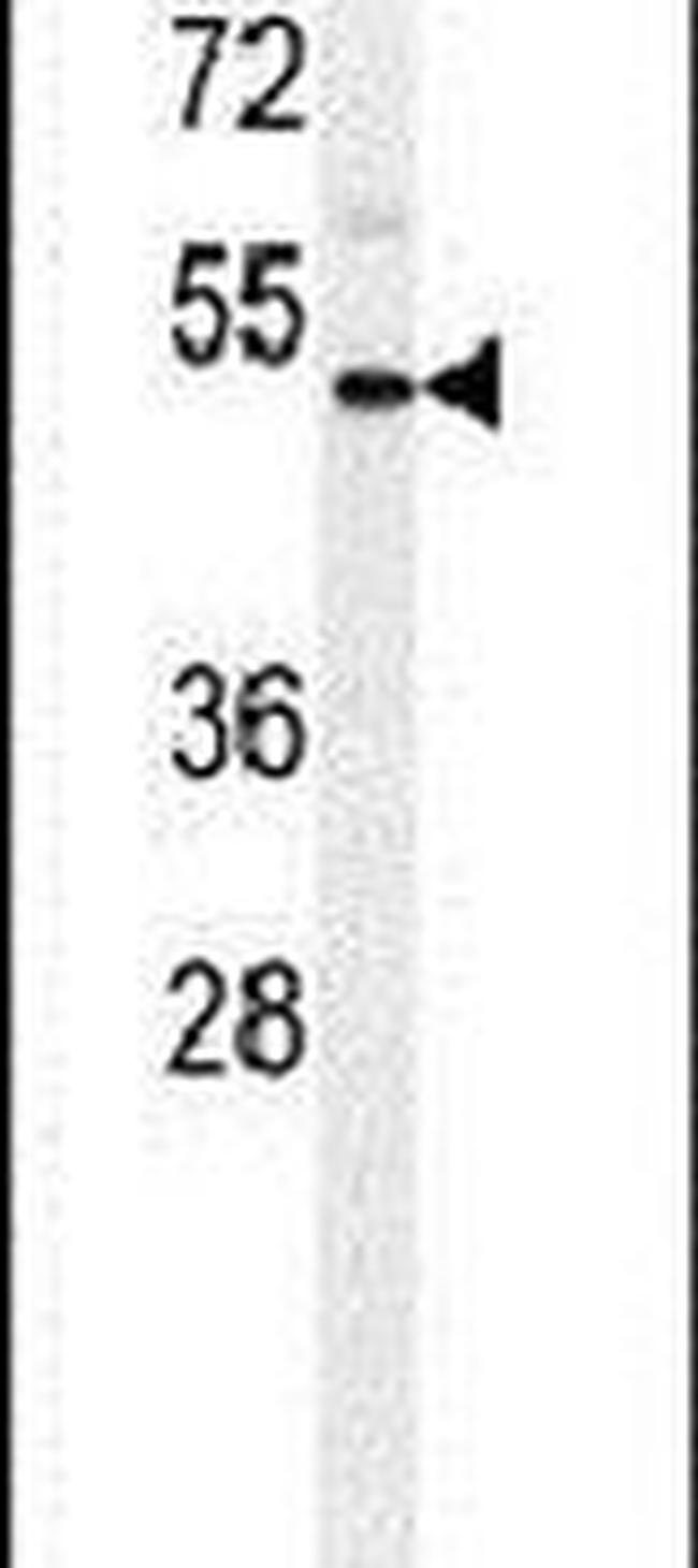 IL1R2 Antibody in Western Blot (WB)