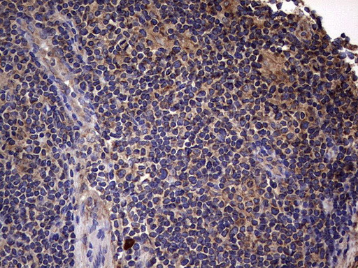 IL1RN Antibody in Immunohistochemistry (Paraffin) (IHC (P))