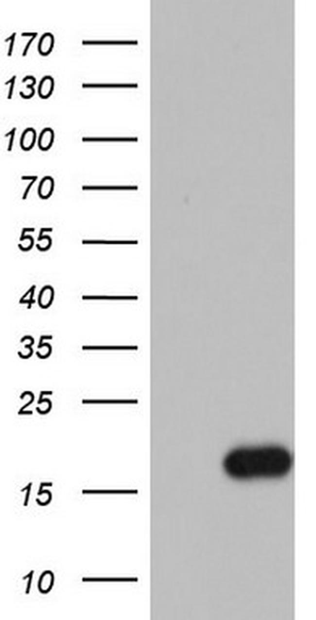 IL1RN Antibody in Western Blot (WB)