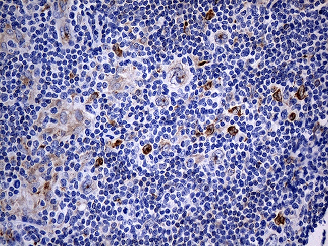 IL2 Antibody in Immunohistochemistry (Paraffin) (IHC (P))