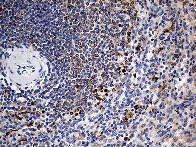 IL2 Antibody in Immunohistochemistry (Paraffin) (IHC (P))