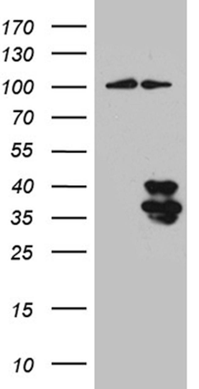 IL34 Antibody in Western Blot (WB)