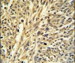 IMPDH2 Antibody in Immunohistochemistry (IHC)