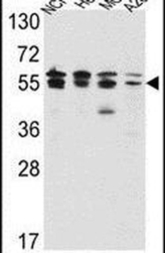 IMPDH2 Antibody in Western Blot (WB)