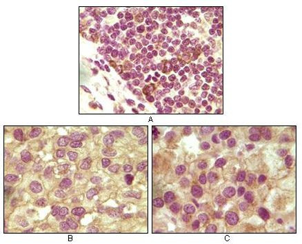 INHA Antibody in Immunohistochemistry (Paraffin) (IHC (P))