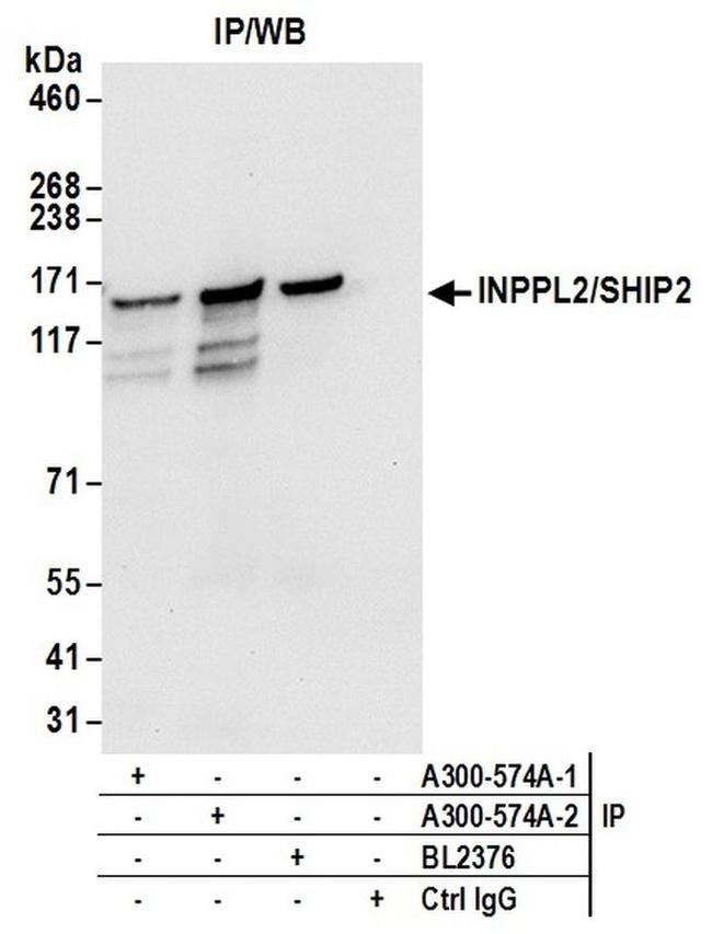 INPPL1/SHIP2 Antibody in Western Blot (WB)