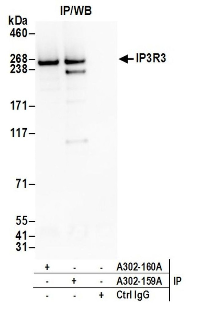 IP3R3 Antibody in Immunoprecipitation (IP)