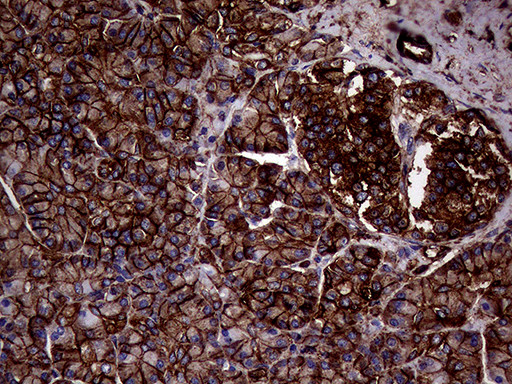 IQGAP1 Antibody in Immunohistochemistry (Paraffin) (IHC (P))