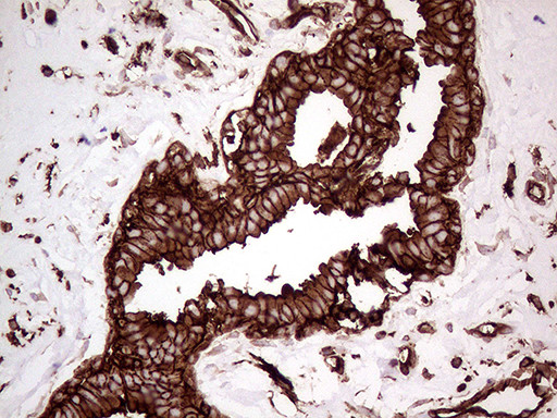 IQGAP1 Antibody in Immunohistochemistry (Paraffin) (IHC (P))