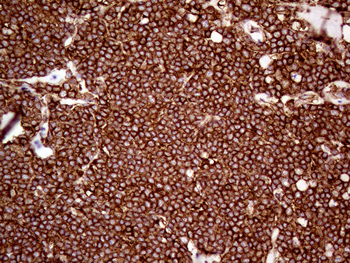 IQGAP1 Antibody in Immunohistochemistry (Paraffin) (IHC (P))