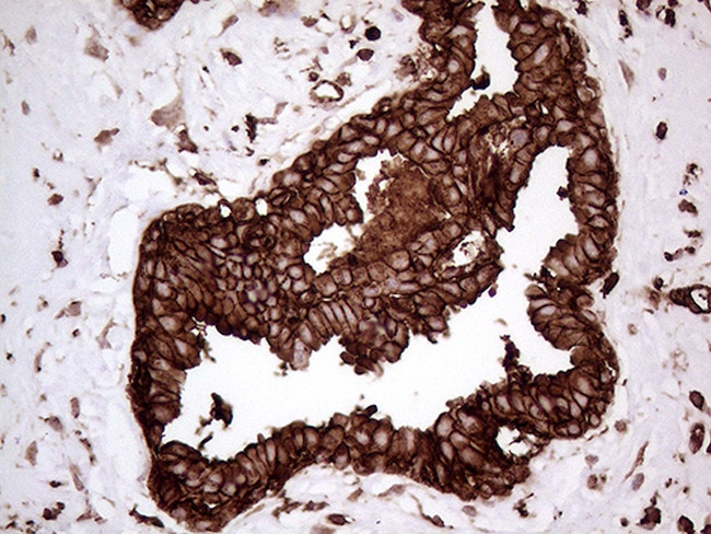 IQGAP1 Antibody in Immunohistochemistry (Paraffin) (IHC (P))