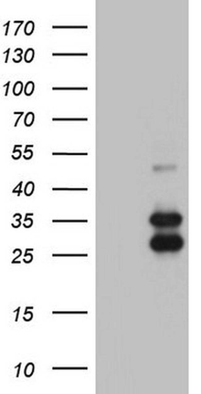 IRAK2 Antibody in Western Blot (WB)