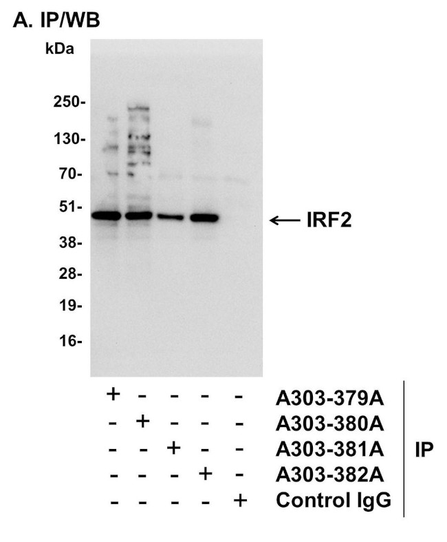 IRF2 Antibody in Immunoprecipitation (IP)