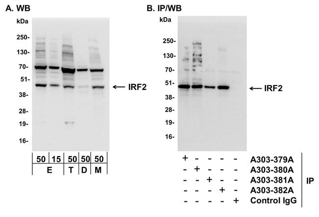 IRF2 Antibody in Western Blot (WB)