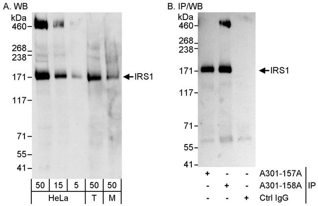 IRS1 Antibody in Western Blot (WB)