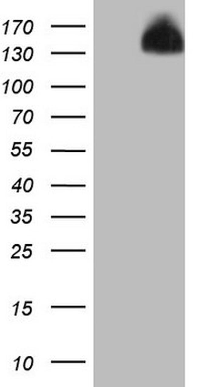 IRS1 Antibody in Western Blot (WB)