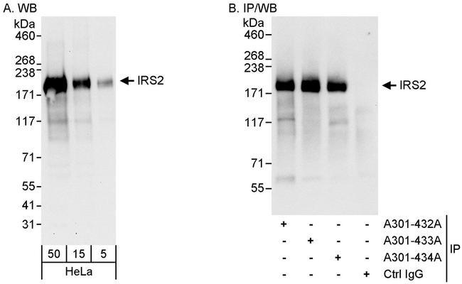 IRS2 Antibody in Western Blot (WB)