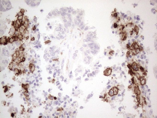 ITGAM Antibody in Immunohistochemistry (Paraffin) (IHC (P))