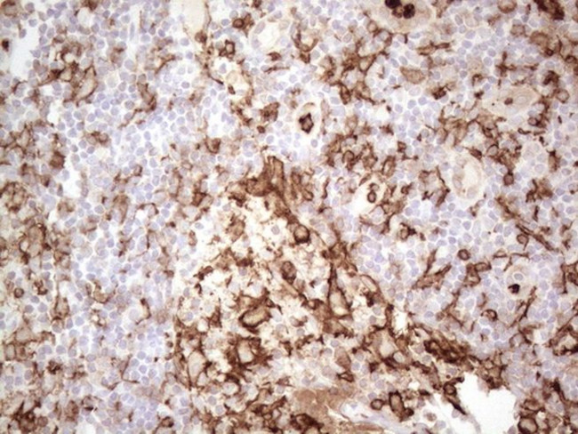 ITGAM Antibody in Immunohistochemistry (Paraffin) (IHC (P))