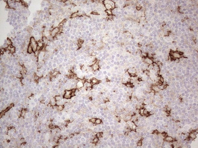 ITGAM Antibody in Immunohistochemistry (Paraffin) (IHC (P))