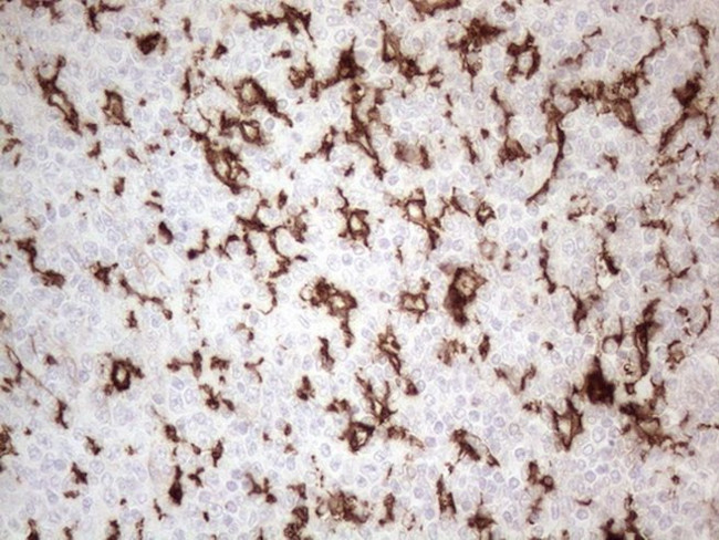 ITGAM Antibody in Immunohistochemistry (Paraffin) (IHC (P))