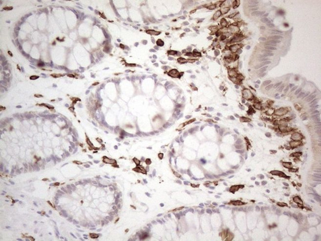 ITGAM Antibody in Immunohistochemistry (Paraffin) (IHC (P))