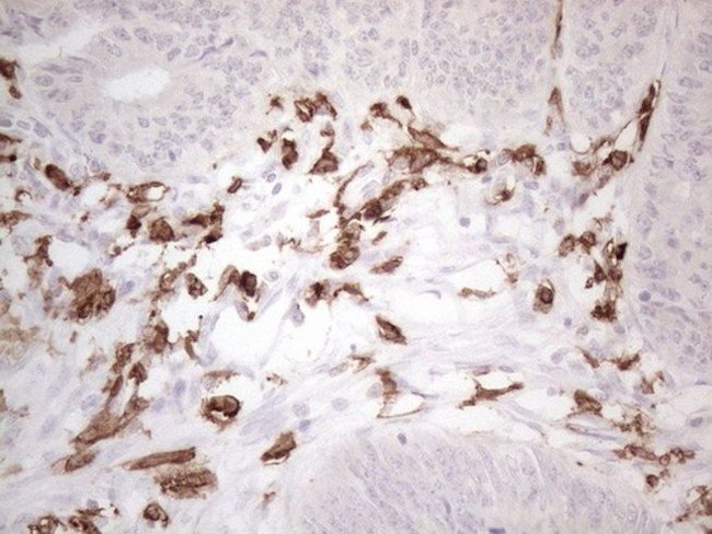 ITGAM Antibody in Immunohistochemistry (Paraffin) (IHC (P))