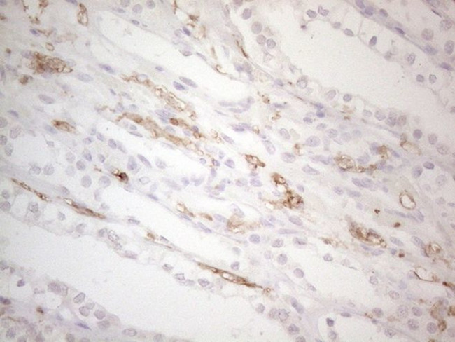 ITGAM Antibody in Immunohistochemistry (Paraffin) (IHC (P))