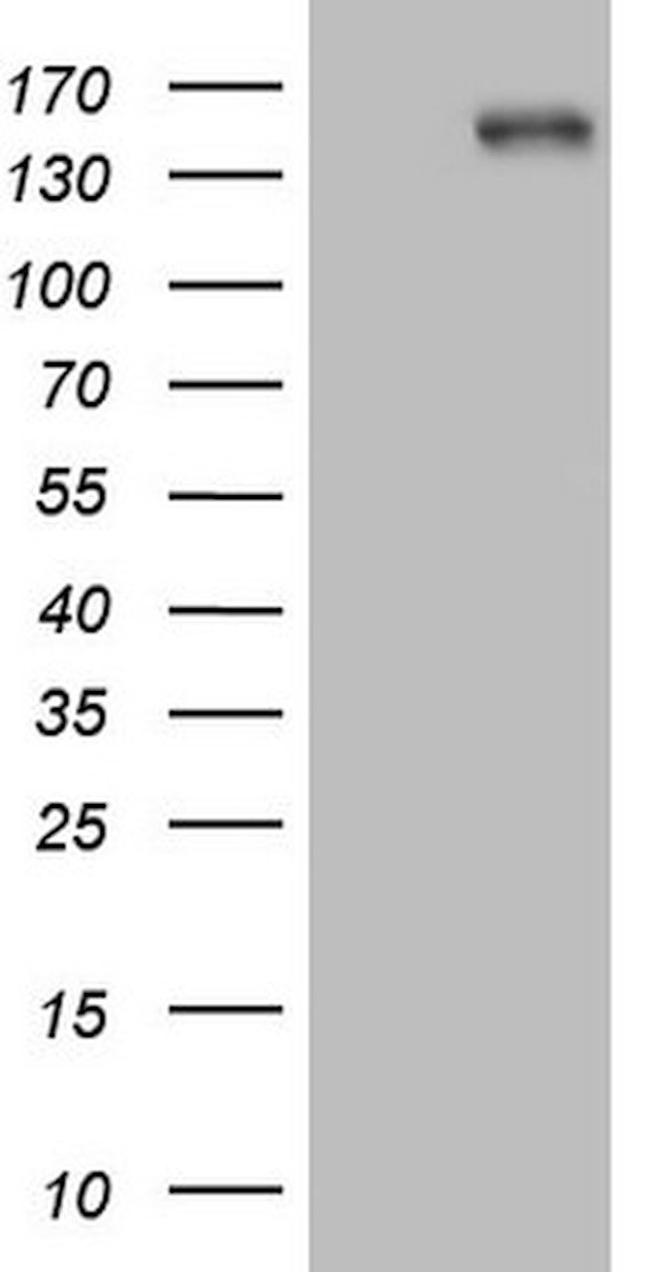 ITGAM Antibody in Western Blot (WB)