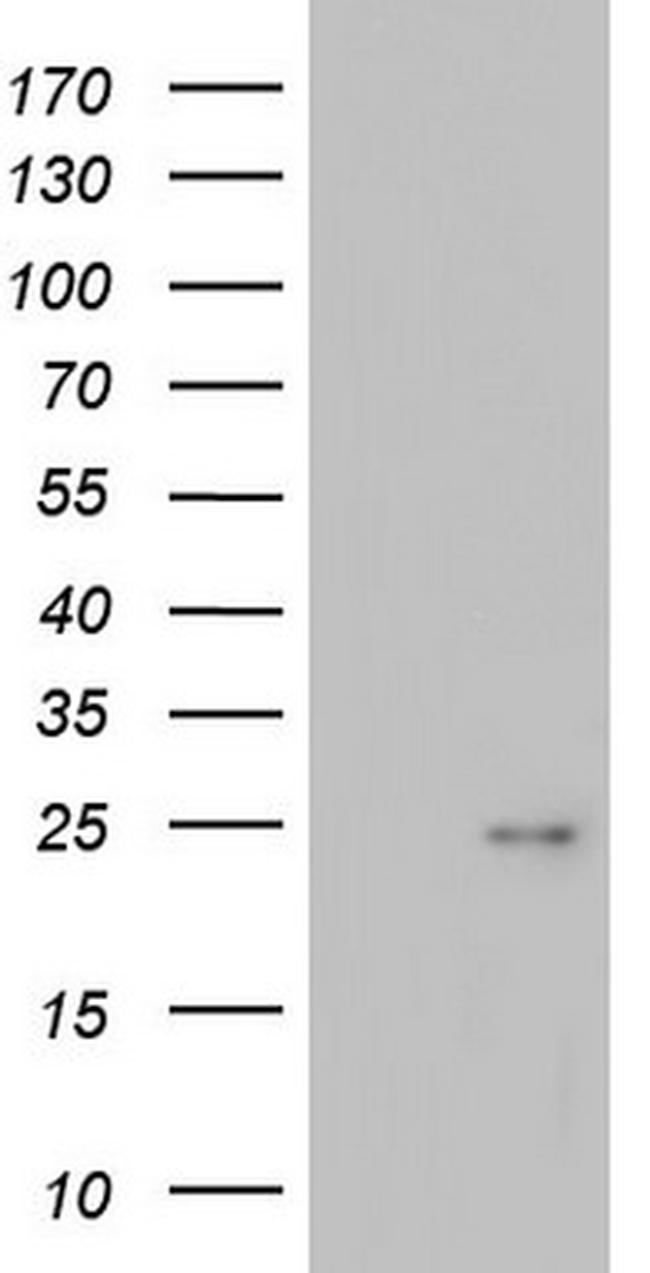 ITGB1BP1 Antibody in Western Blot (WB)