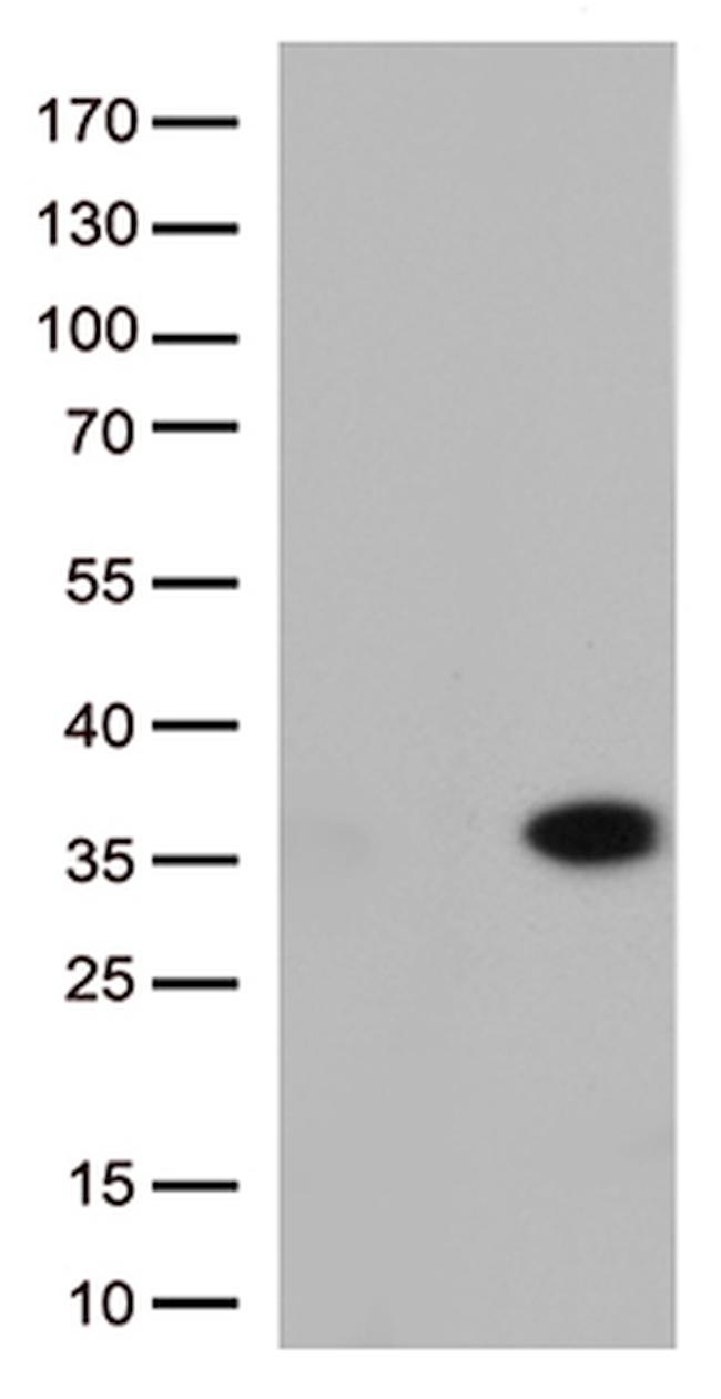 ITGB1BP3 Antibody in Western Blot (WB)