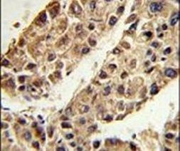 ITIH2 Antibody in Immunohistochemistry (IHC)