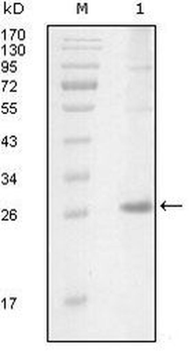 ITK Antibody in Western Blot (WB)