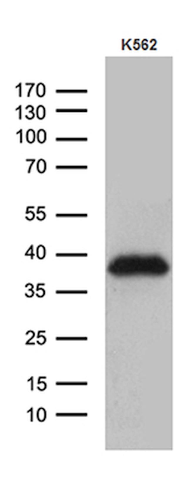 ITM2A Antibody in Western Blot (WB)