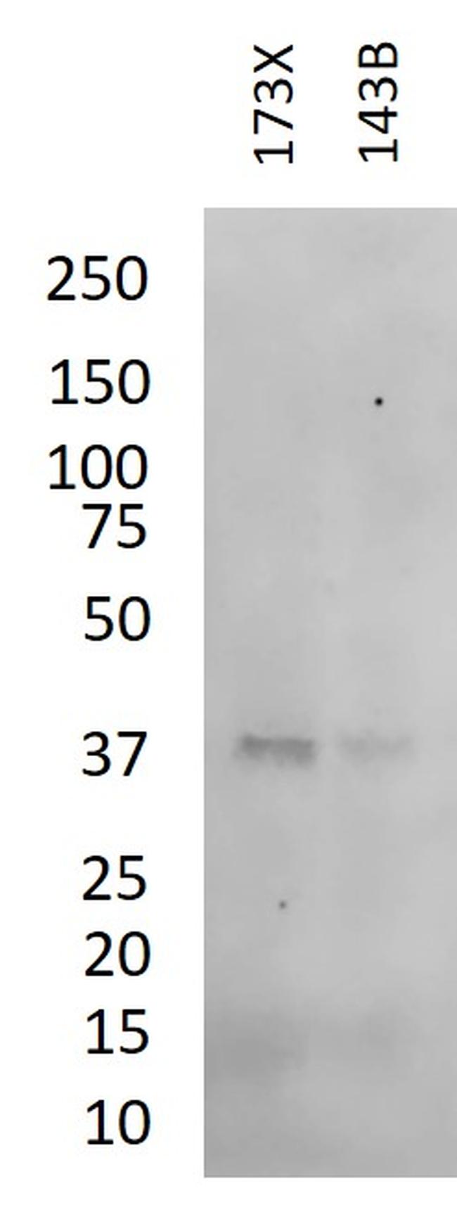 IkB alpha Antibody in Western Blot (WB)