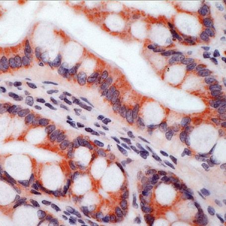 ITGB5 Antibody in Immunohistochemistry (IHC)