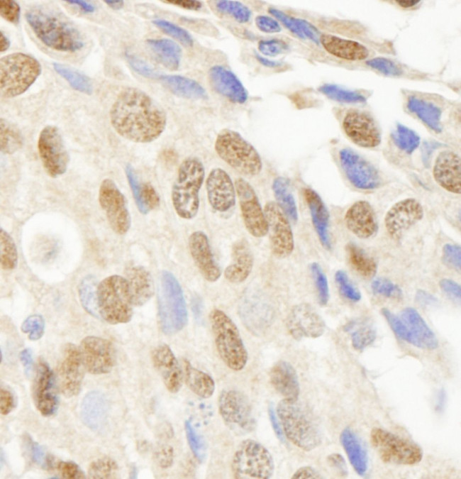 JHDM1A Antibody in Immunohistochemistry (IHC)