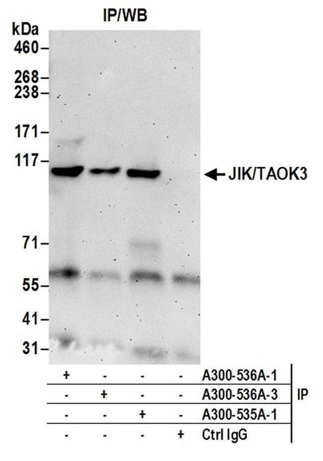 JIK/TAOK3 Antibody in Western Blot (WB)