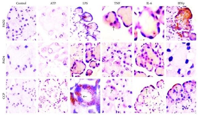 PADI2 Antibody in Immunohistochemistry (IHC)