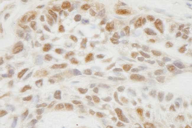 JMJD1C Antibody in Immunohistochemistry (IHC)