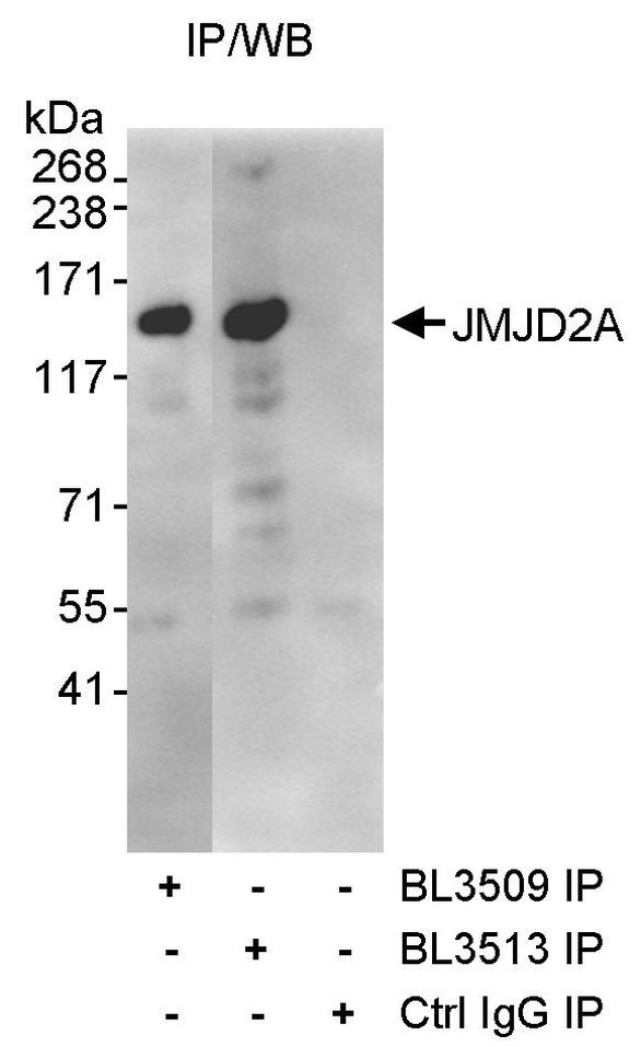 JMJD2A Antibody in Immunoprecipitation (IP)