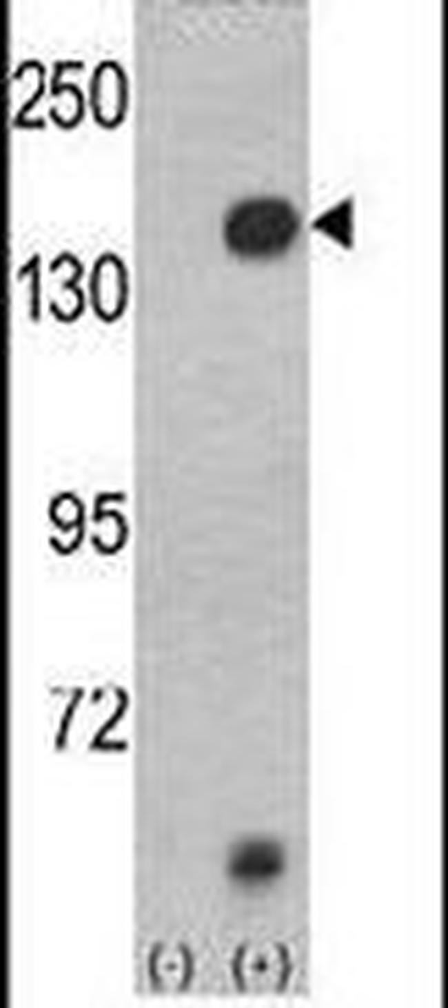 JMJD2A Antibody in Western Blot (WB)