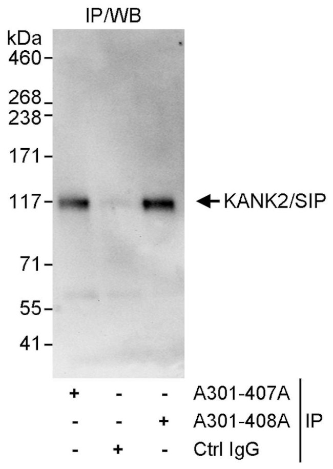 KANK2/SIP Antibody in Immunoprecipitation (IP)