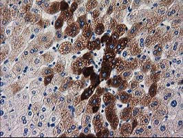 KATNAL1 Antibody in Immunohistochemistry (Paraffin) (IHC (P))