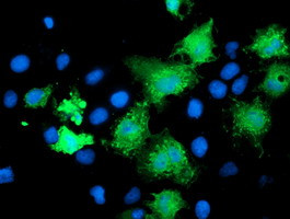 KATNB1 Antibody in Immunocytochemistry (ICC/IF)