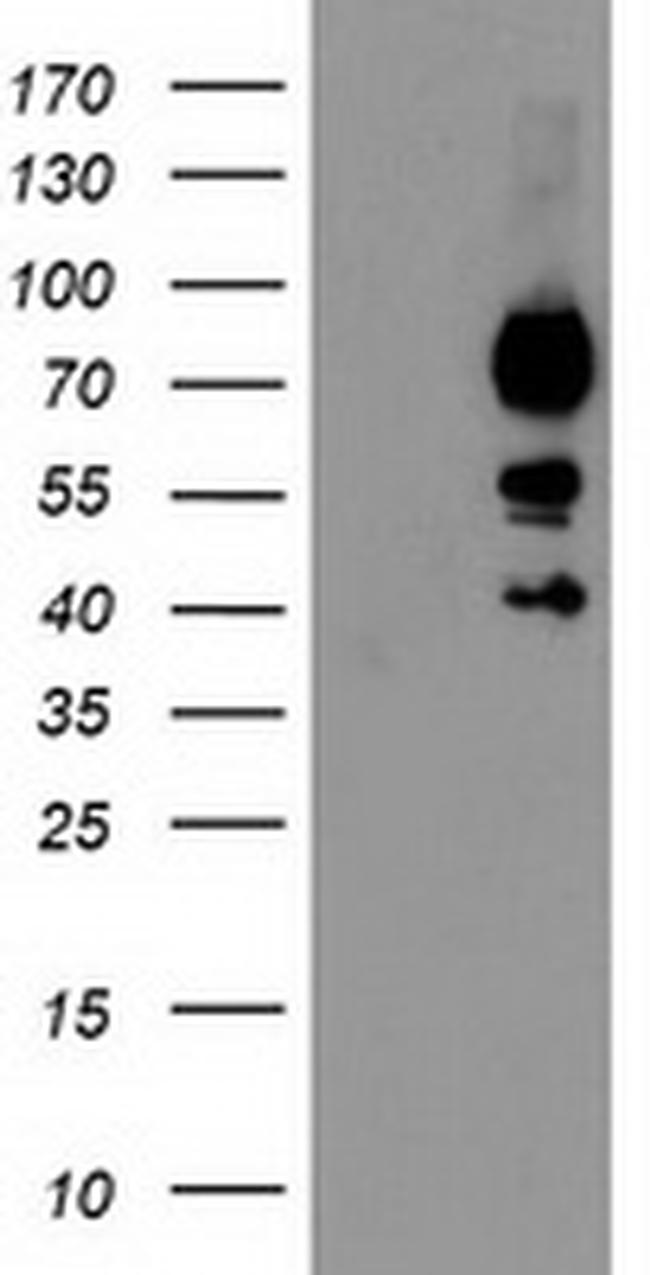 KATNB1 Antibody in Western Blot (WB)