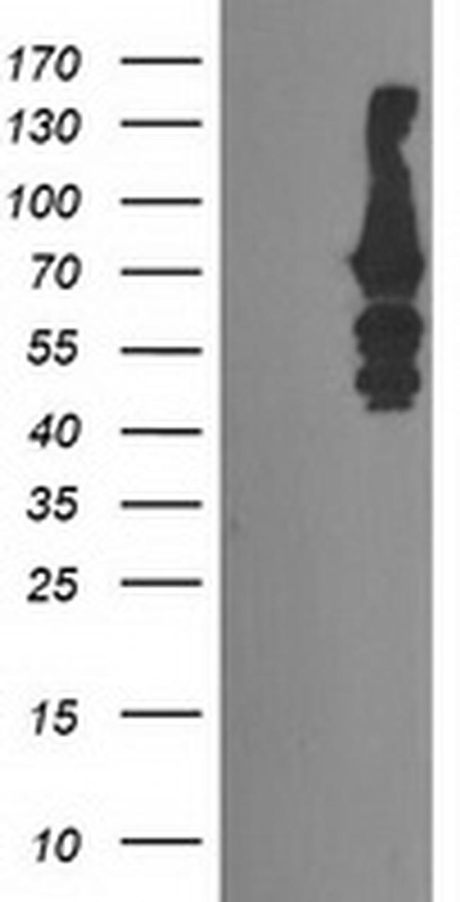 KATNB1 Antibody in Western Blot (WB)