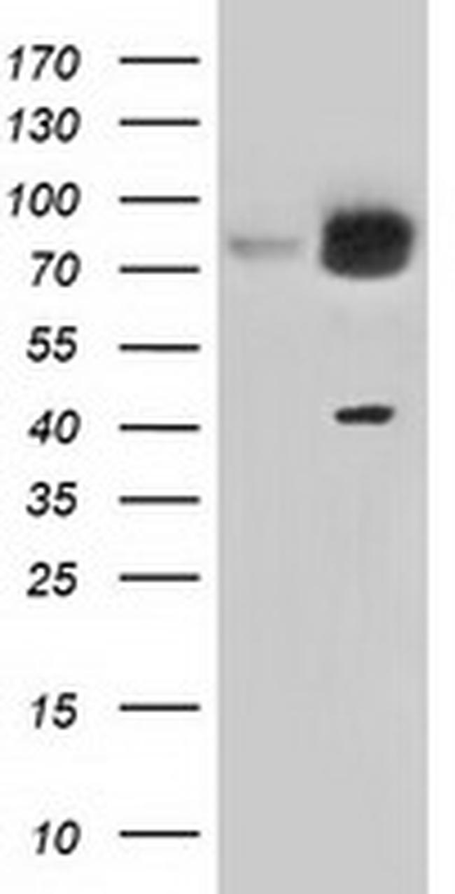 KBTBD7 Antibody in Western Blot (WB)